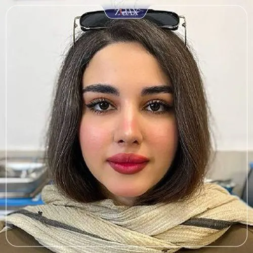 نمونه عمل جراحی بینی دکتر سجاد پیشگر — تصویر 3