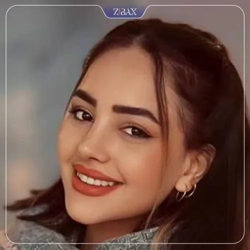 نمونه عمل جراحی بینی دکتر سجاد پیشگر — تصویر 6