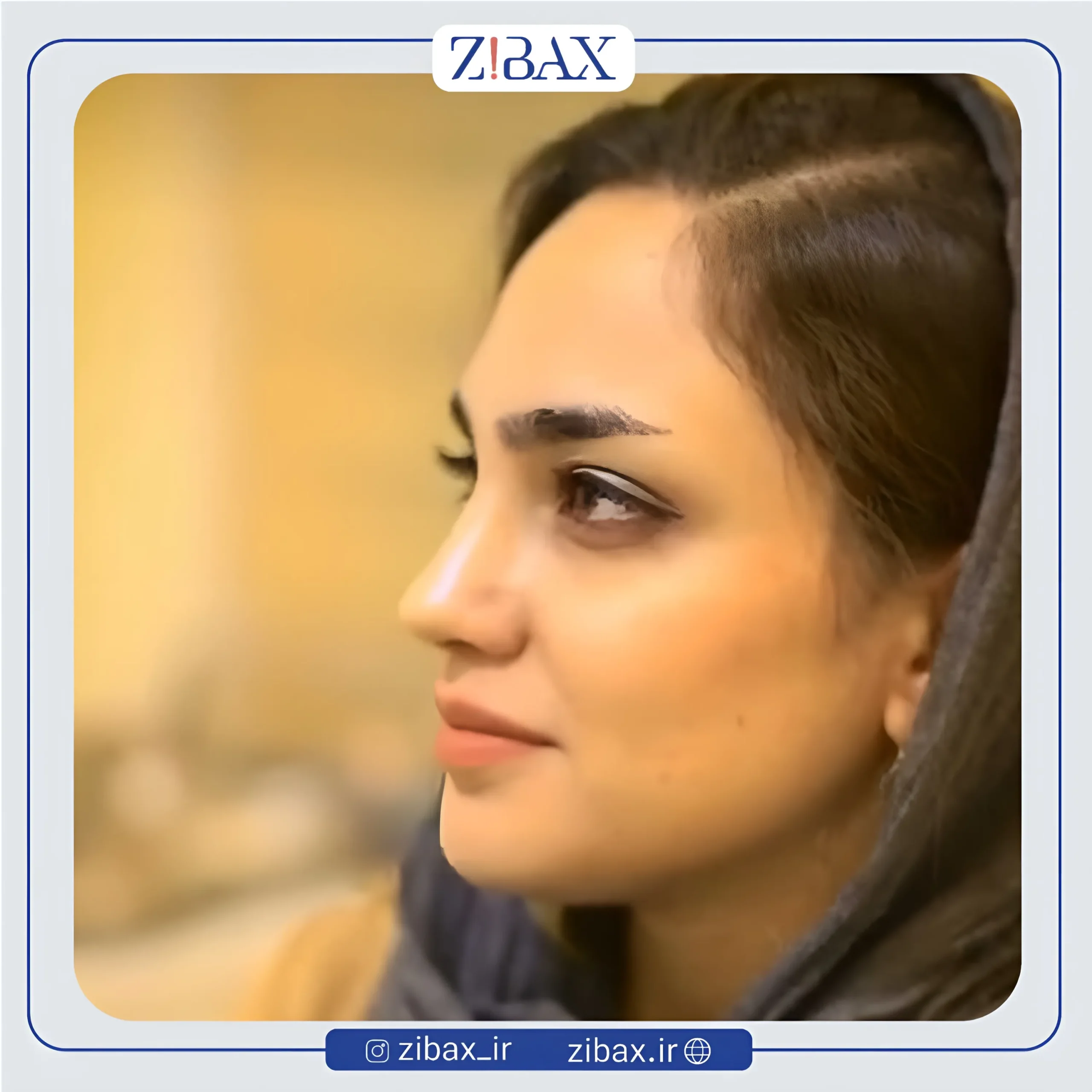 نمونه عمل جراحی بینی دکتر حمیدرضا راستی — تصویر 7