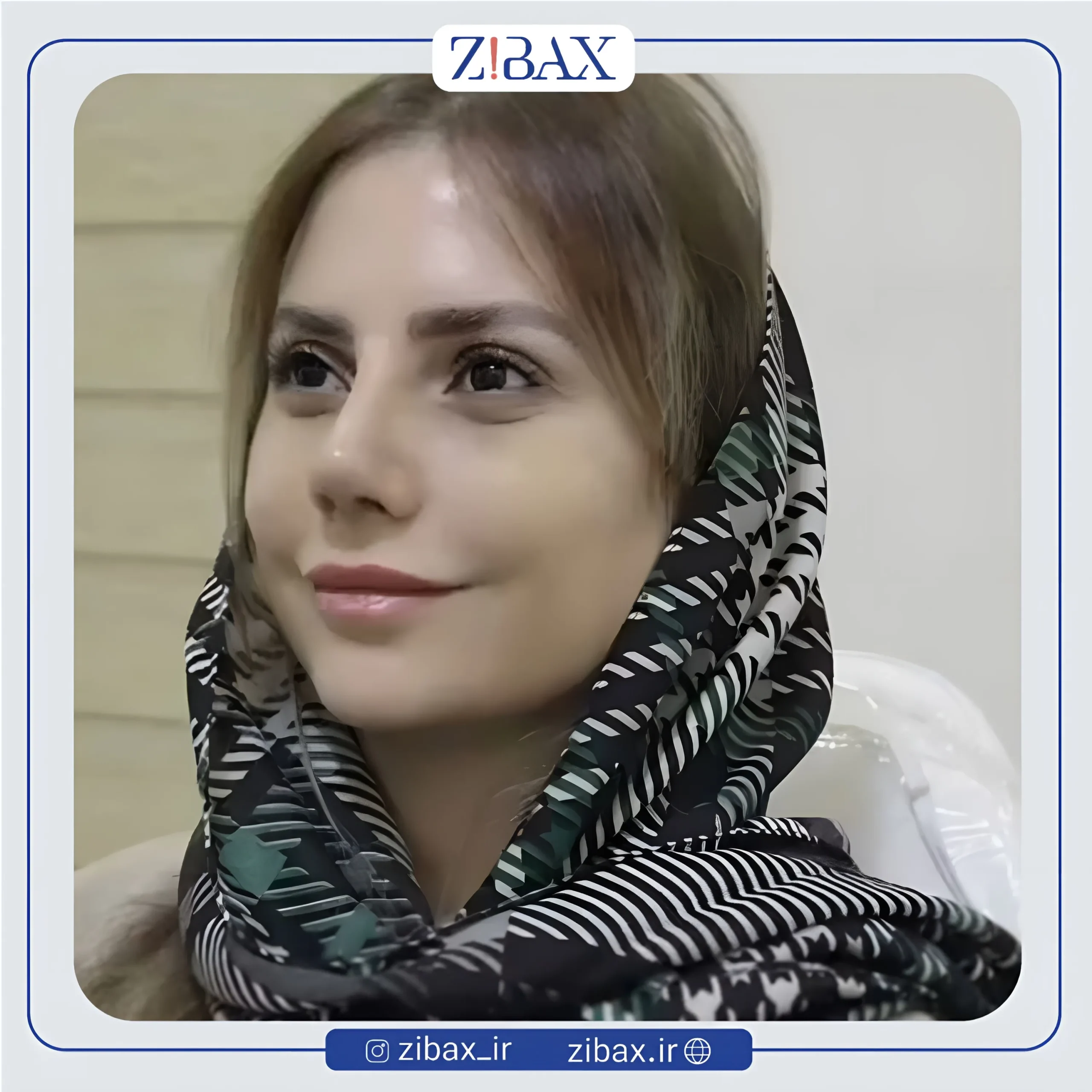 نمونه عمل جراحی بینی دکتر حمیدرضا راستی — تصویر 8