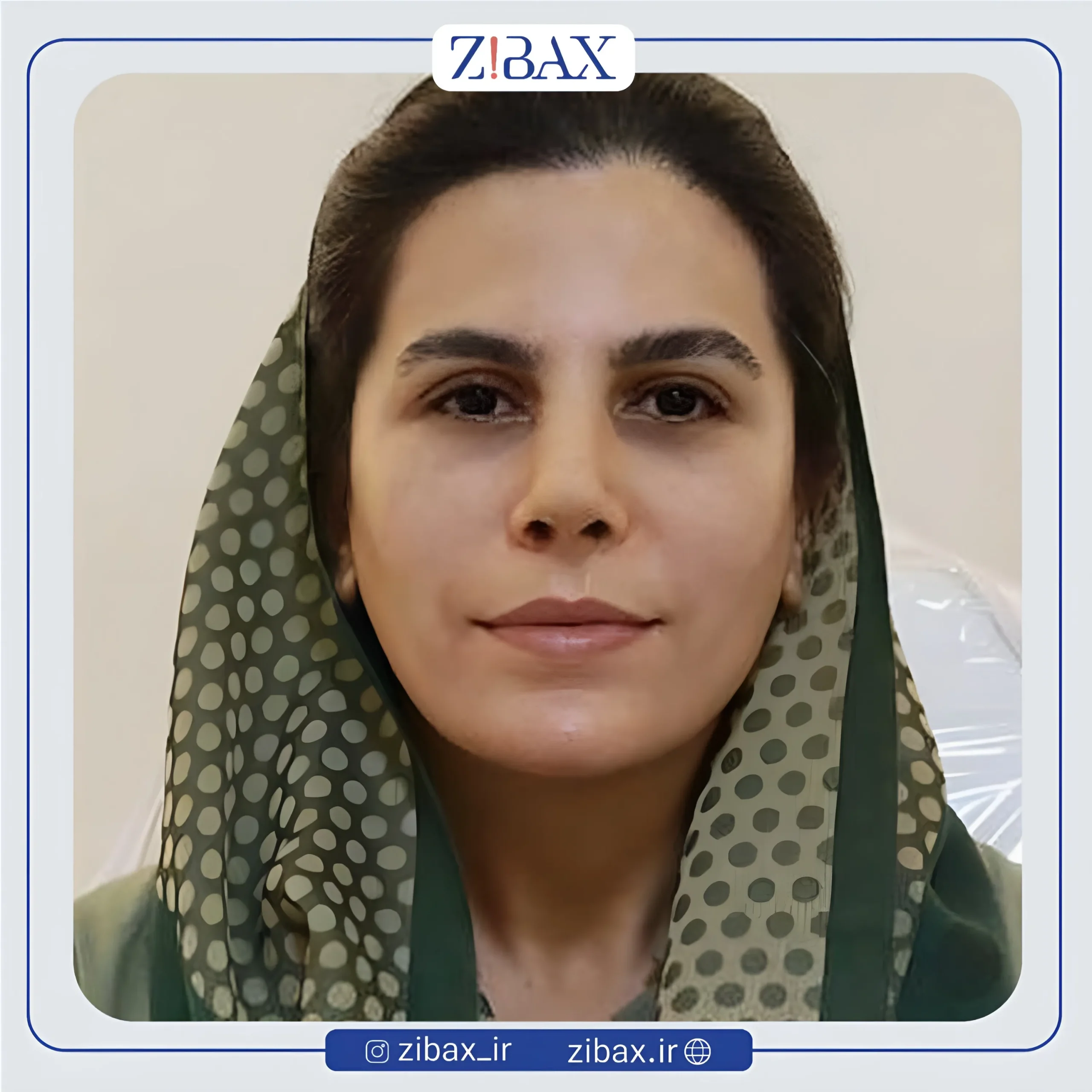 نمونه عمل جراحی بینی دکتر حمیدرضا راستی — تصویر 10