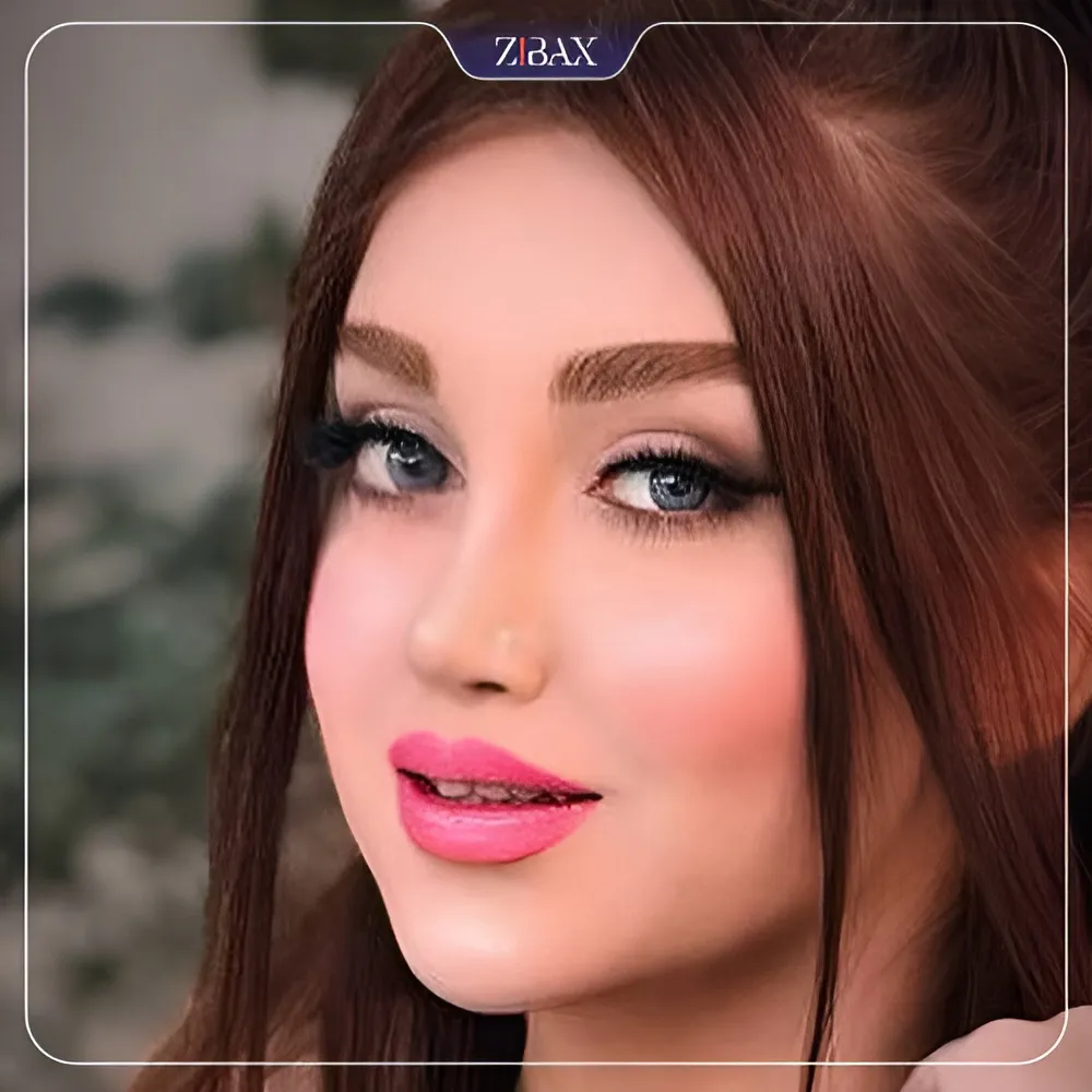 نمونه عمل جراحی بینی دکتر آرزو خوانساری نیا — تصویر 3