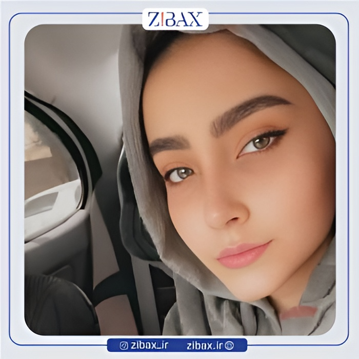 نمونه عمل جراحی بینی دکتر سعیدرضا توفیقی — تصویر 7