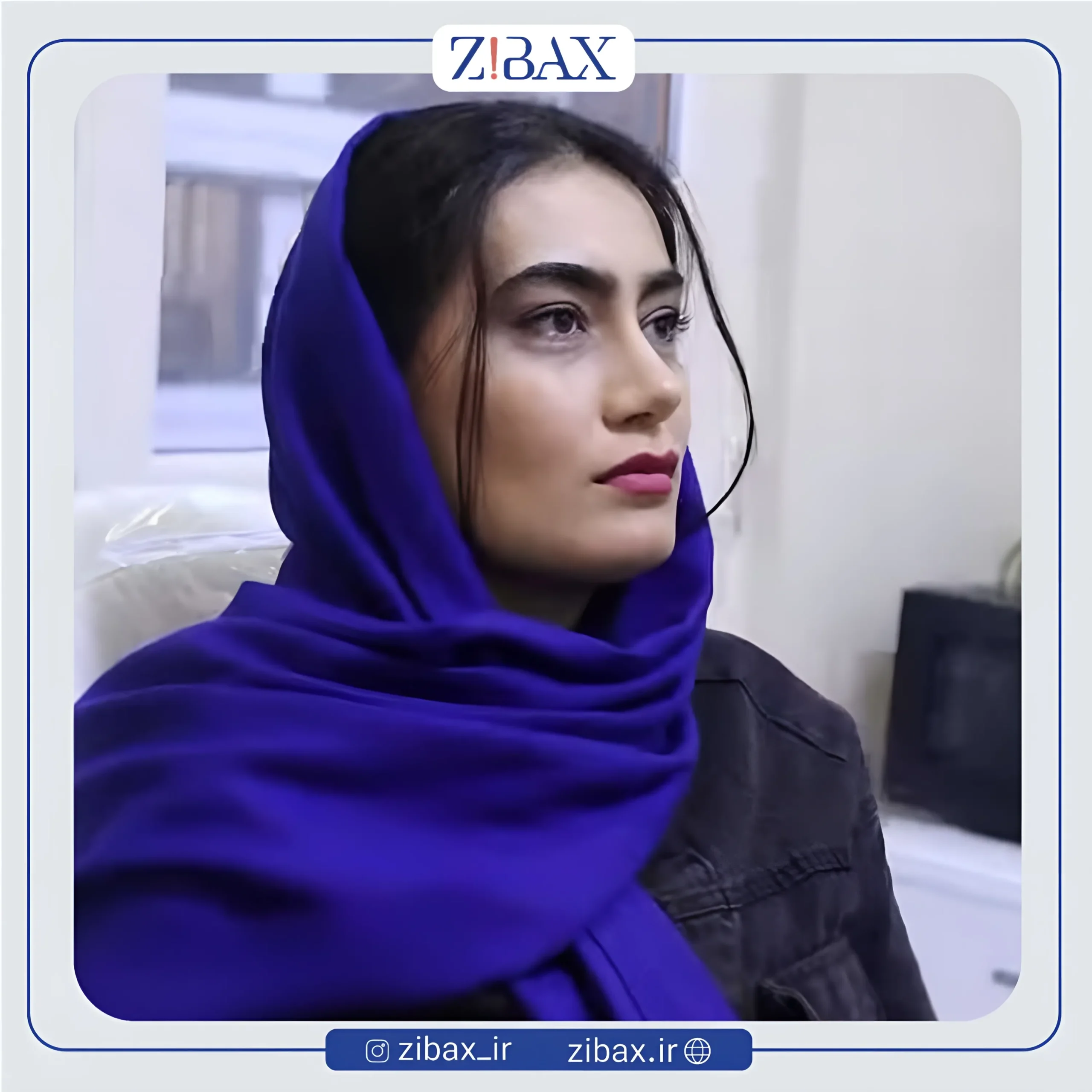 نمونه عمل جراحی بینی دکتر حمیدرضا راستی — تصویر 1