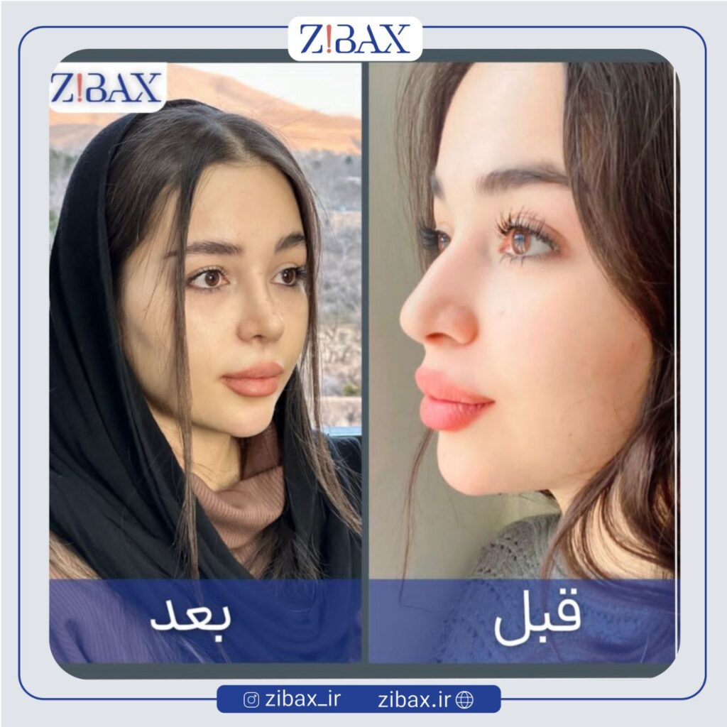 نمونه جراحی زیبایی با مجموعه زیباکس