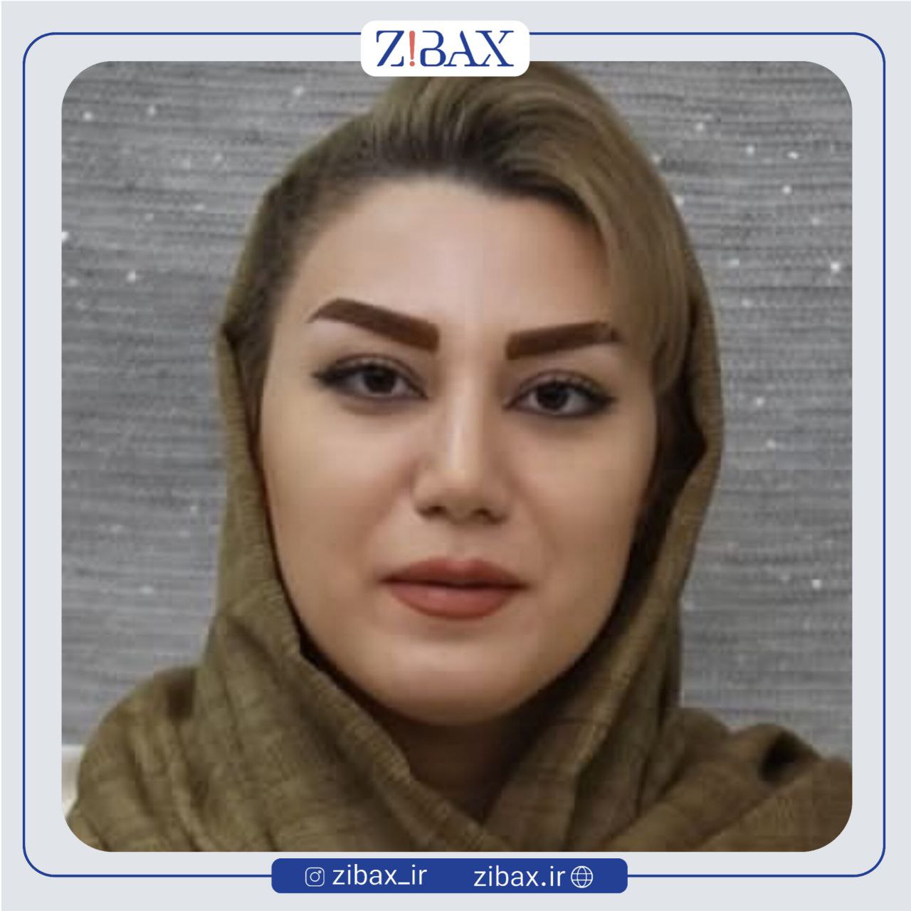 نمونه عمل جراحی بینی دکتر یوسف یعقوبلو — تصویر 3