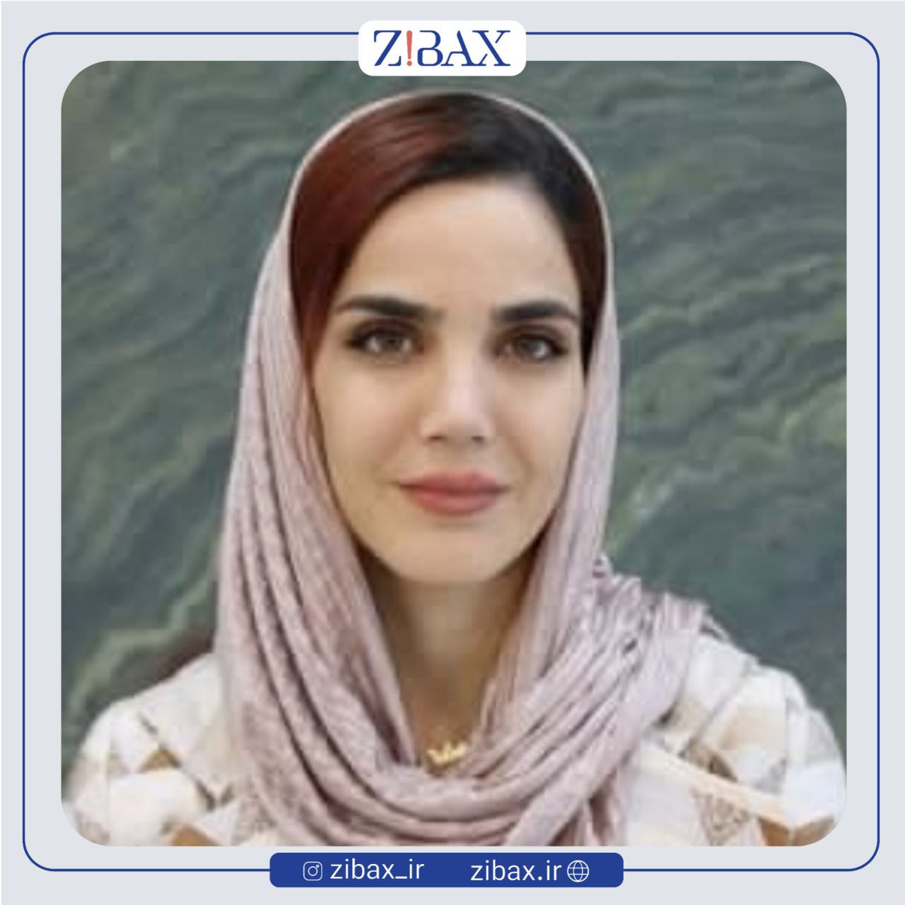 نمونه عمل جراحی بینی دکتر یوسف یعقوبلو — تصویر 6