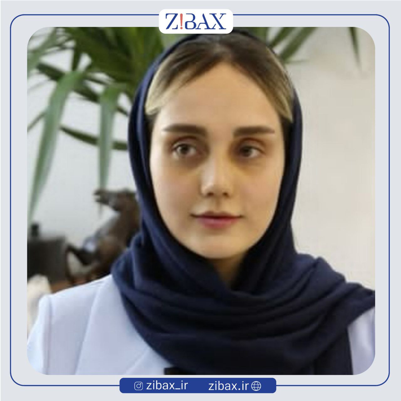 نمونه عمل جراحی بینی دکتر یوسف یعقوبلو — تصویر 7