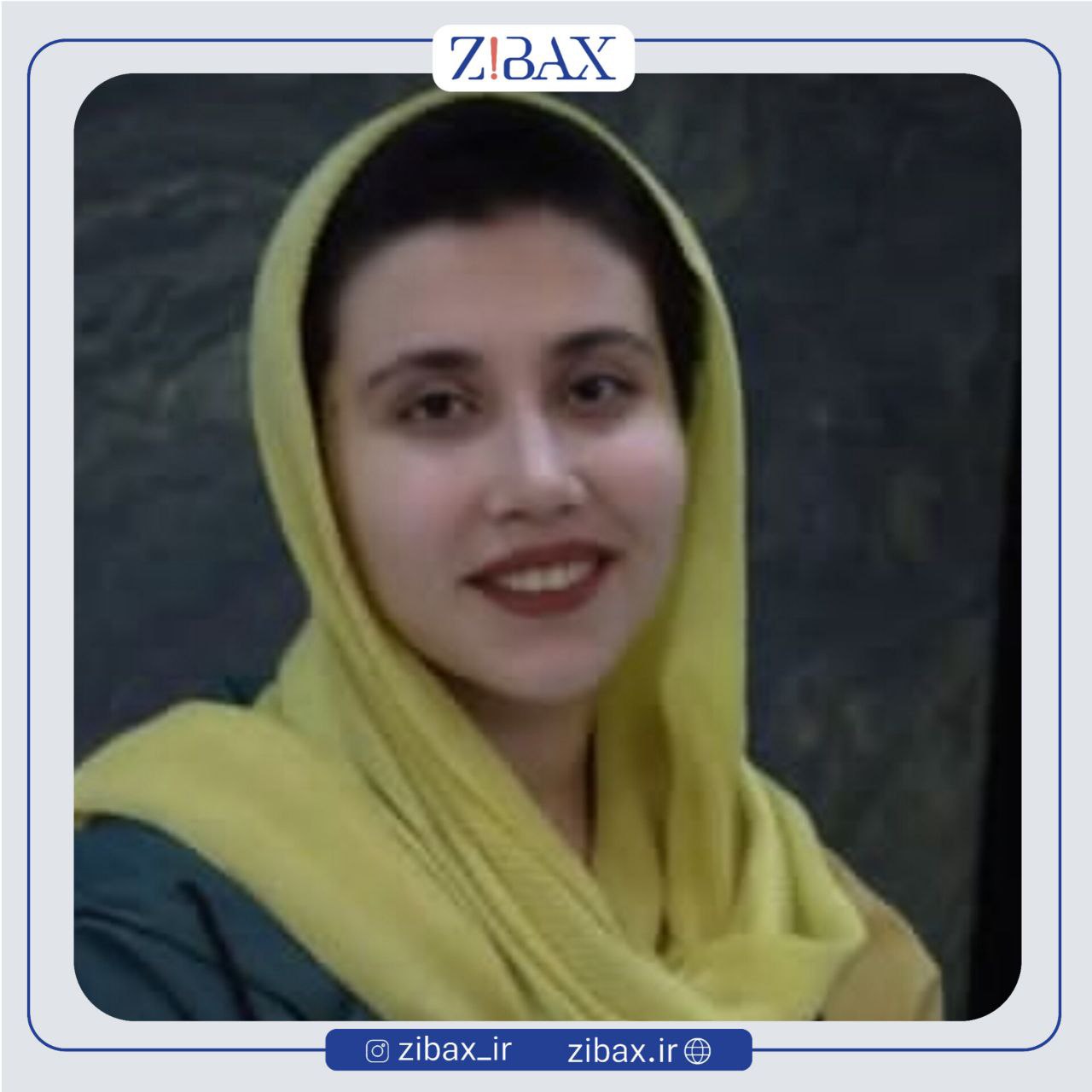نمونه عمل جراحی بینی دکتر یوسف یعقوبلو — تصویر 8