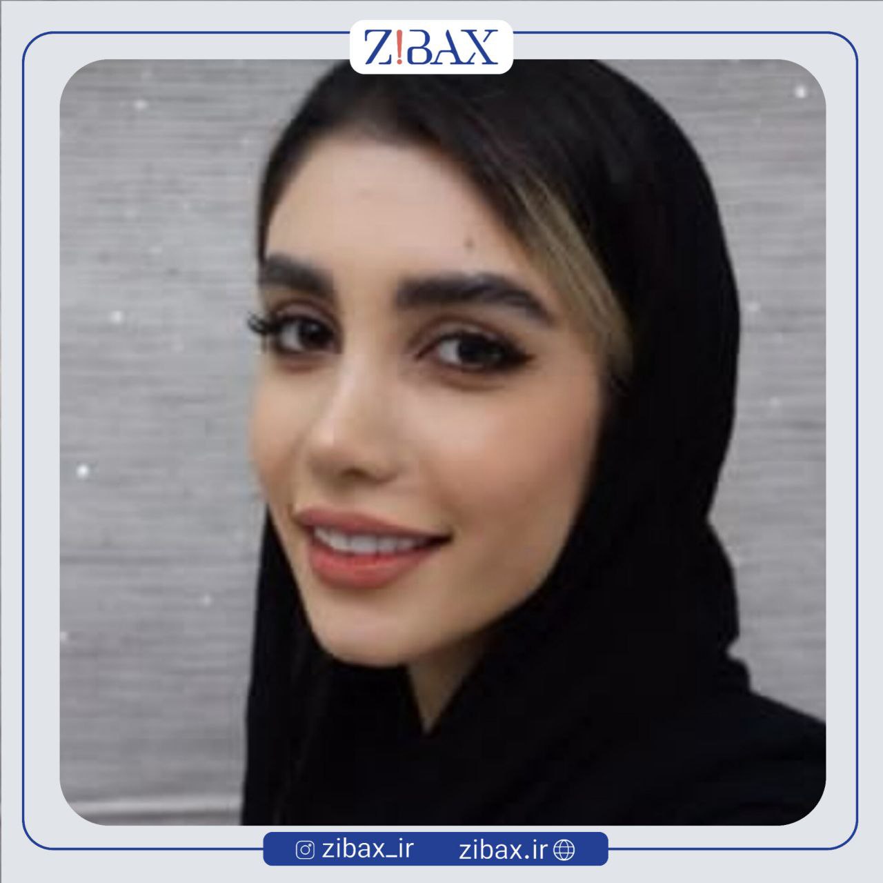 نمونه عمل جراحی بینی دکتر یوسف یعقوبلو — تصویر 9