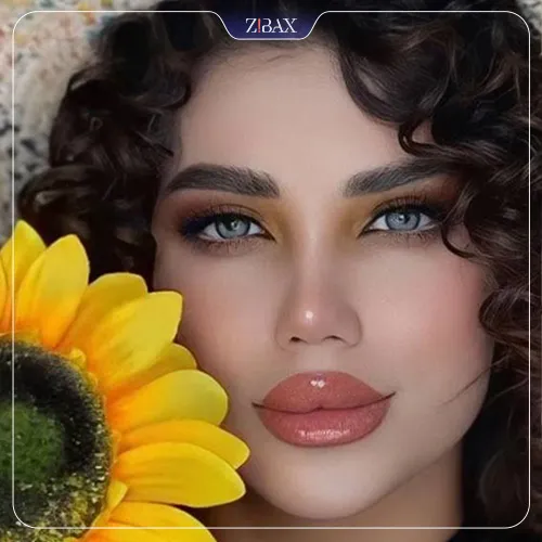 نمونه عمل جراحی بینی دکتر آزاده مرادی — تصویر 9