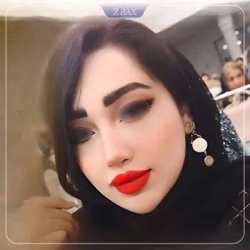 نمونه عمل جراحی بینی دکتر دنیا کرمی — تصویر 4