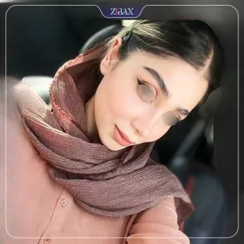 نمونه عمل جراحی بینی دکتر دنیا کرمی — تصویر 1