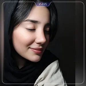 نمونه عمل جراحی بینی دکتر حاتم صالح پور — تصویر 8
