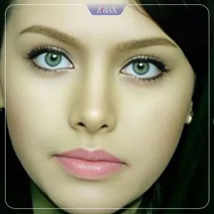 نمونه عمل جراحی بینی دکتر هرمز بازیاری دلاور — تصویر 4