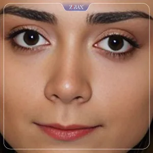نمونه عمل جراحی بینی دکتر هرمز بازیاری دلاور — تصویر 6