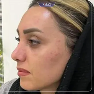 نمونه عمل جراحی بینی مهرداد جعفری — تصویر 8