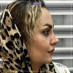 نمونه عمل جراحی بینی مهرداد جعفری — تصویر 7