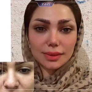 نمونه عمل جراحی بینی دکتر رضا بدیعی — تصویر 1
