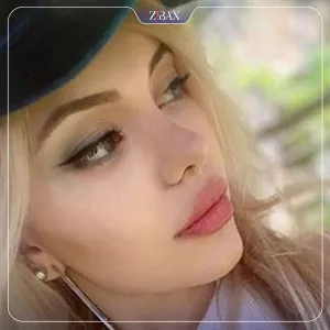 نمونه عمل جراحی بینی دکتر رضا بدیعی — تصویر 6