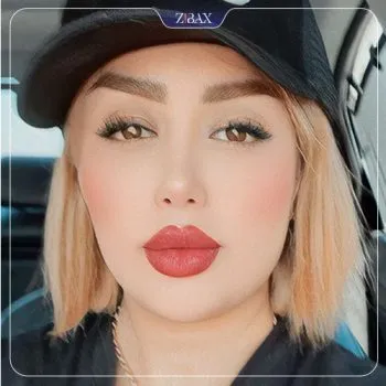 نمونه عمل جراحی بینی دکتر شهره اکرمی ابرقوئ — تصویر 4