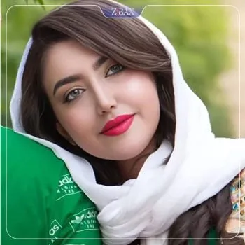 نمونه عمل جراحی بینی دکتر شهره اکرمی ابرقوئ — تصویر 5