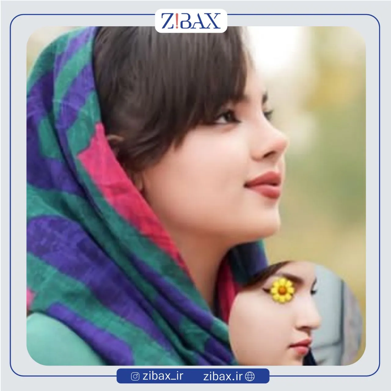نمونه عمل جراحی بینی دکتر امین میراحمدی — تصویر 4