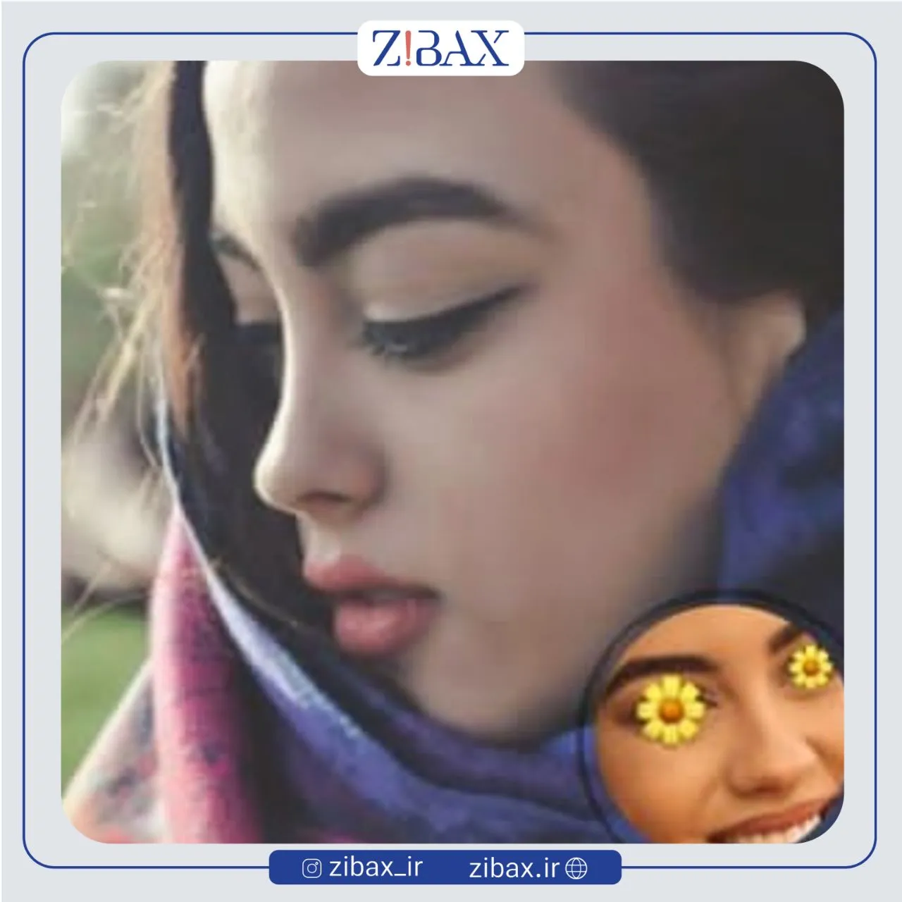 نمونه عمل جراحی بینی دکتر امین میراحمدی — تصویر 1