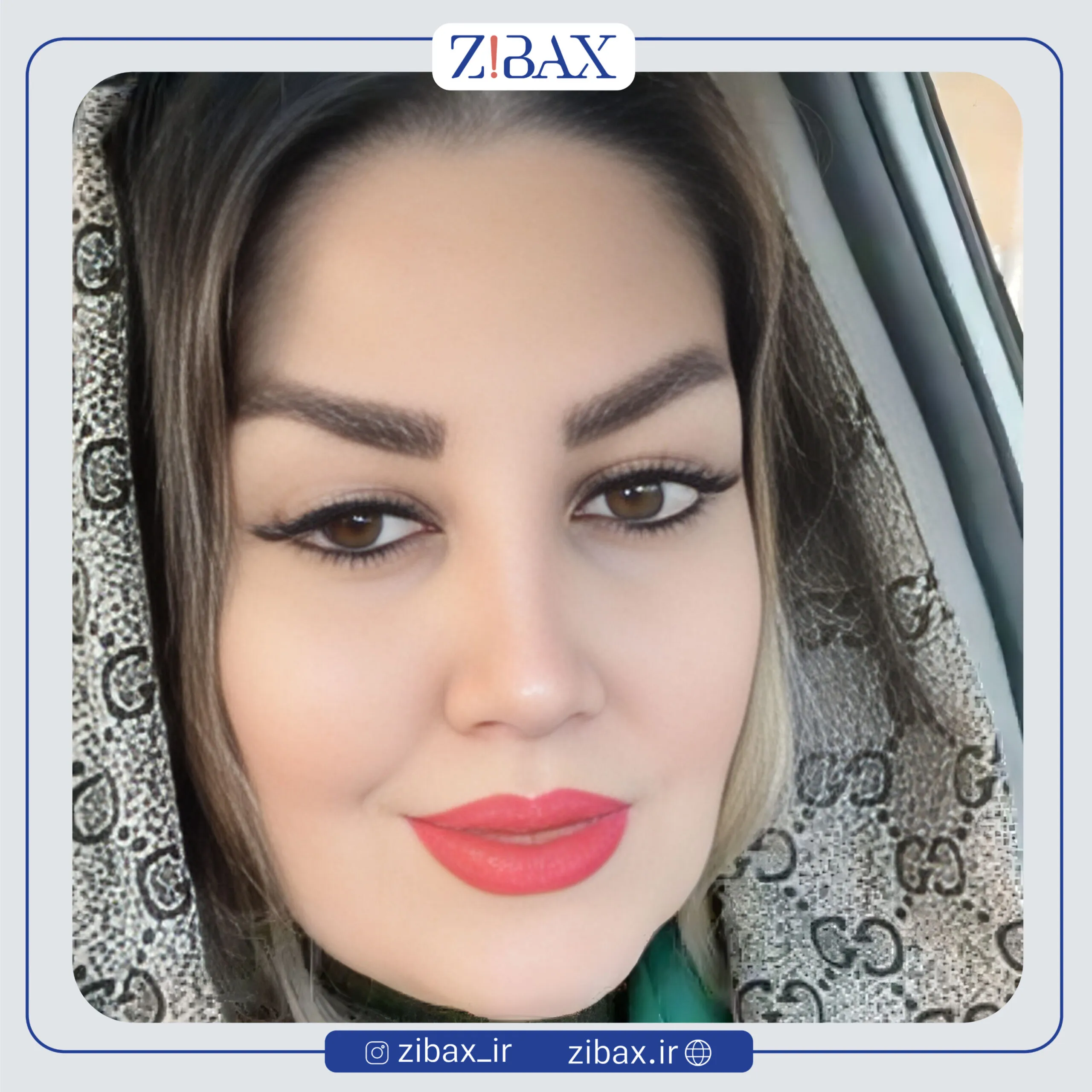 نمونه عمل جراحی بینی دکتر الهام کابلی — تصویر 12
