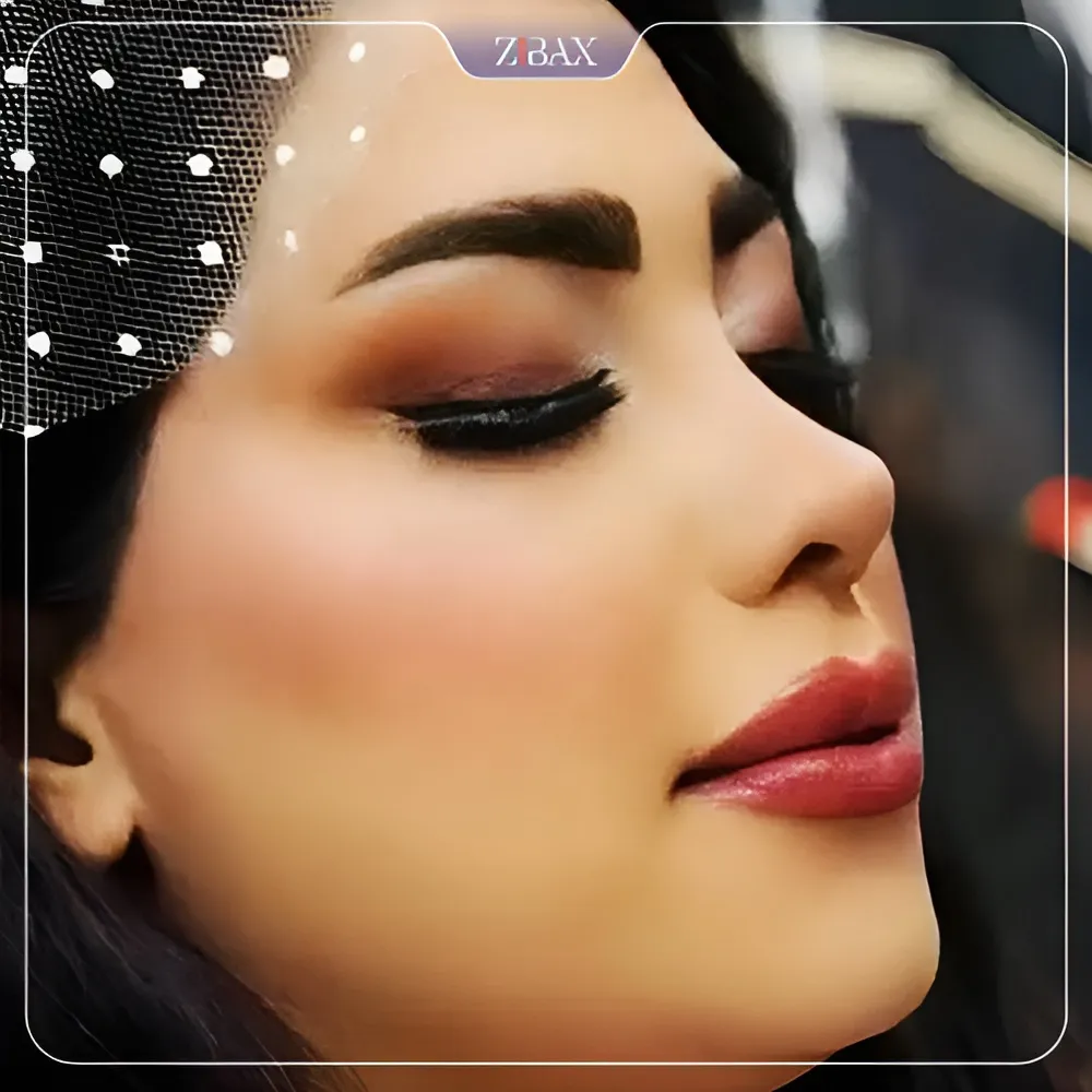 نمونه عمل جراحی بینی دکتر زهرا خسروی — تصویر 3