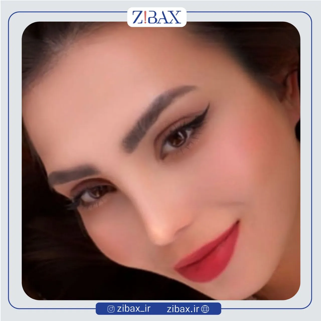 نمونه عمل جراحی بینی دکتر امین میراحمدی — تصویر 9
