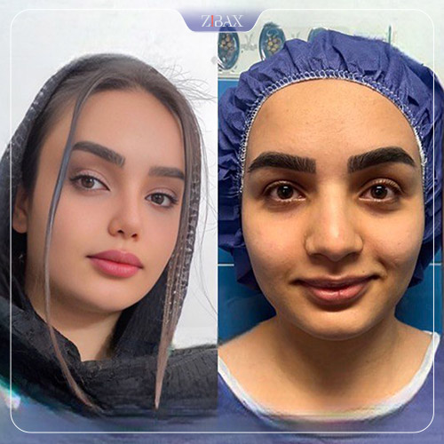 نتیجه جراحی