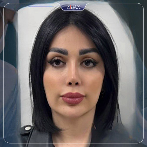 نتیجه جراحی