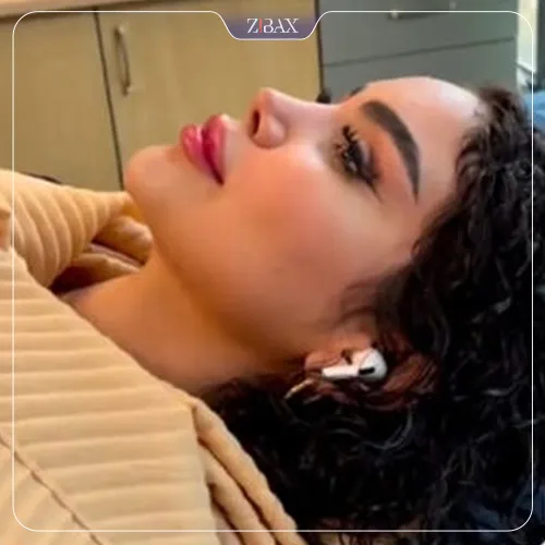 نمونه عمل جراحی بینی دکتر بهرام مقدم فرد — تصویر 5