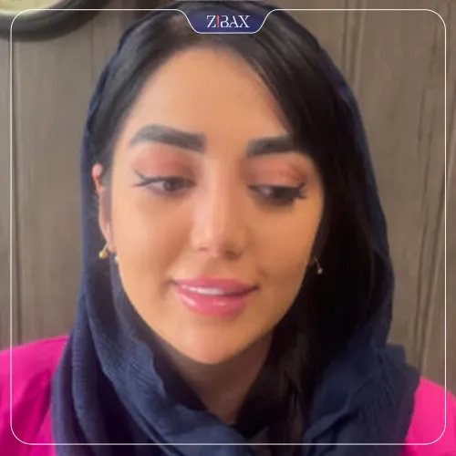 نمونه عمل جراحی بینی دکتر بهرام مقدم فرد — تصویر 6