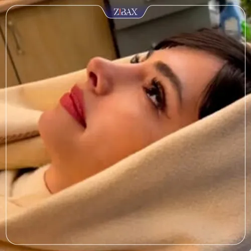 نتیجه جراحی