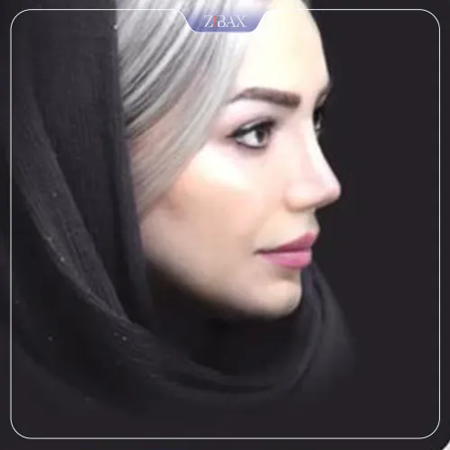 نمونه عمل جراحی بینی دکتر احمد زمانیان — تصویر 6
