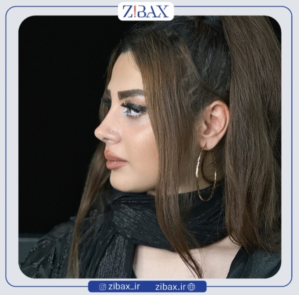 نمونه عمل بینی طبیعی در تهران با مشاوره زیباکس