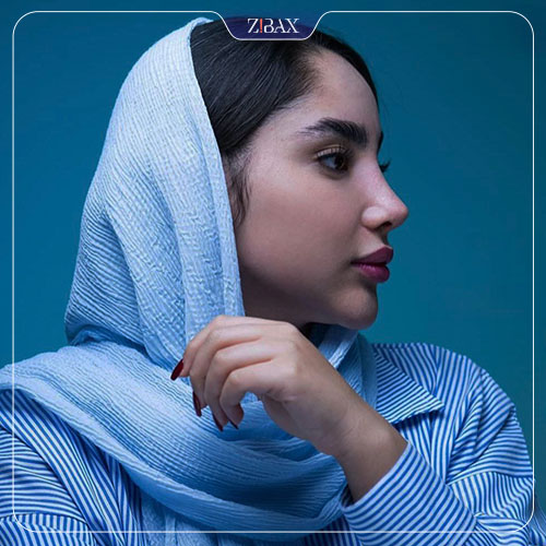 عمل بینی نیمه فانتزی دخترانه با مشاوره زیباکس
