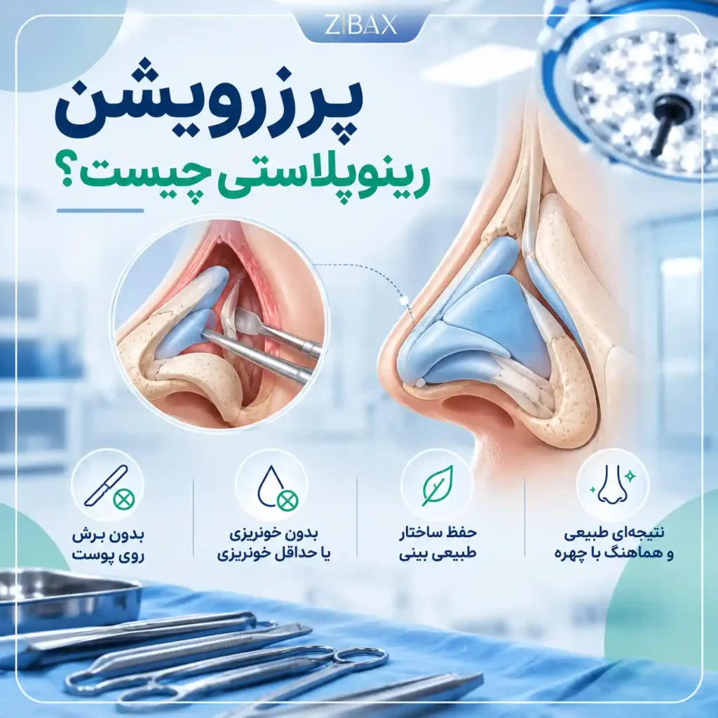پرزرویشن چیست
