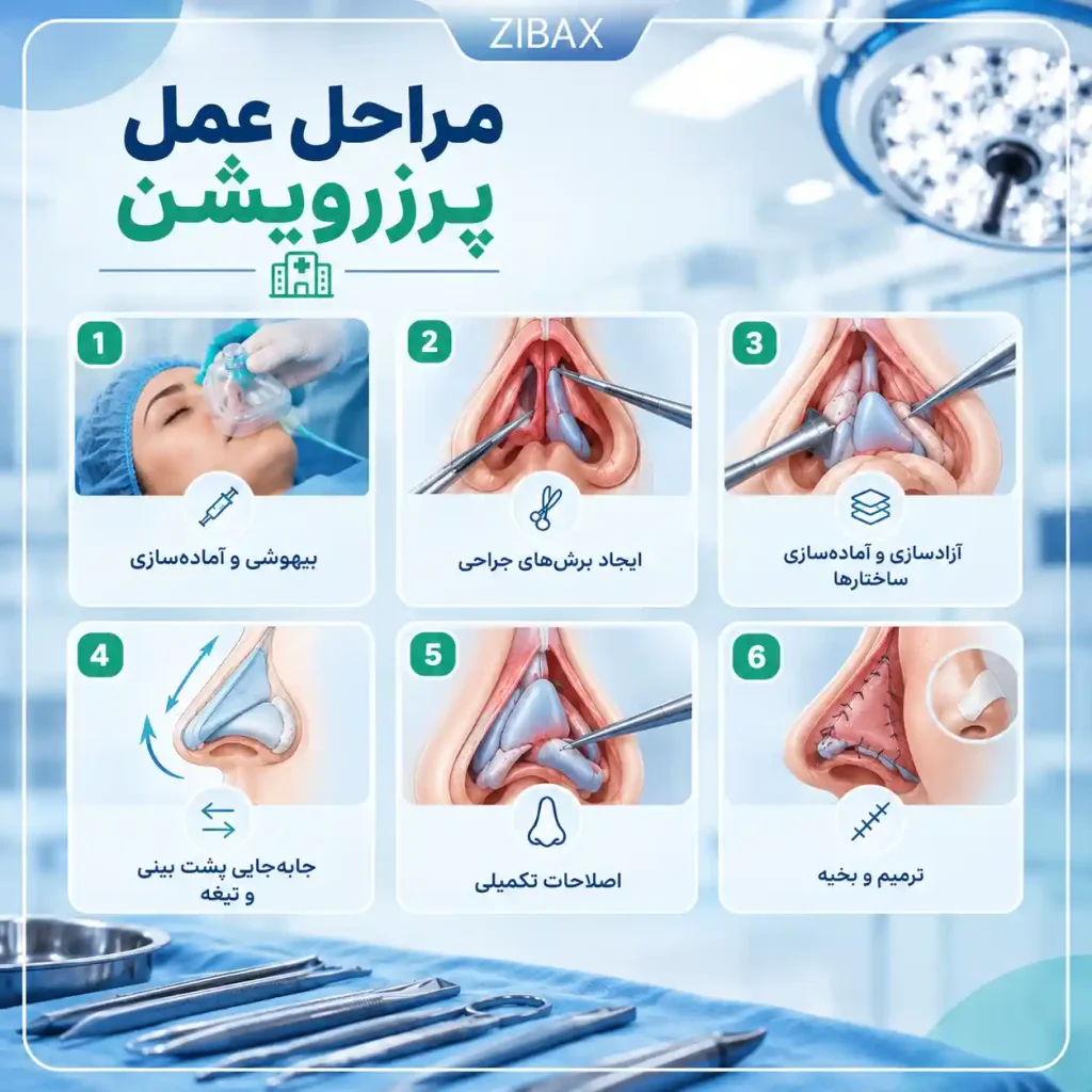 مراحل پرزرویشن رینوپلاستی