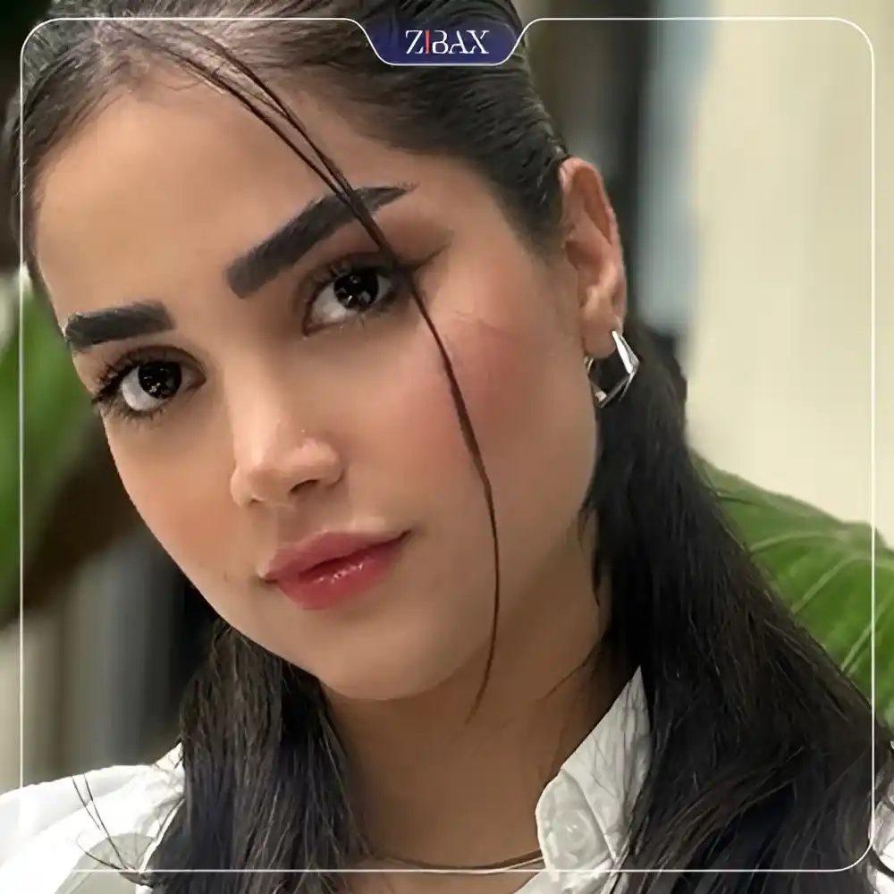 نمونه عمل جراحی بینی دکتر آرش شرفیان — تصویر 3
