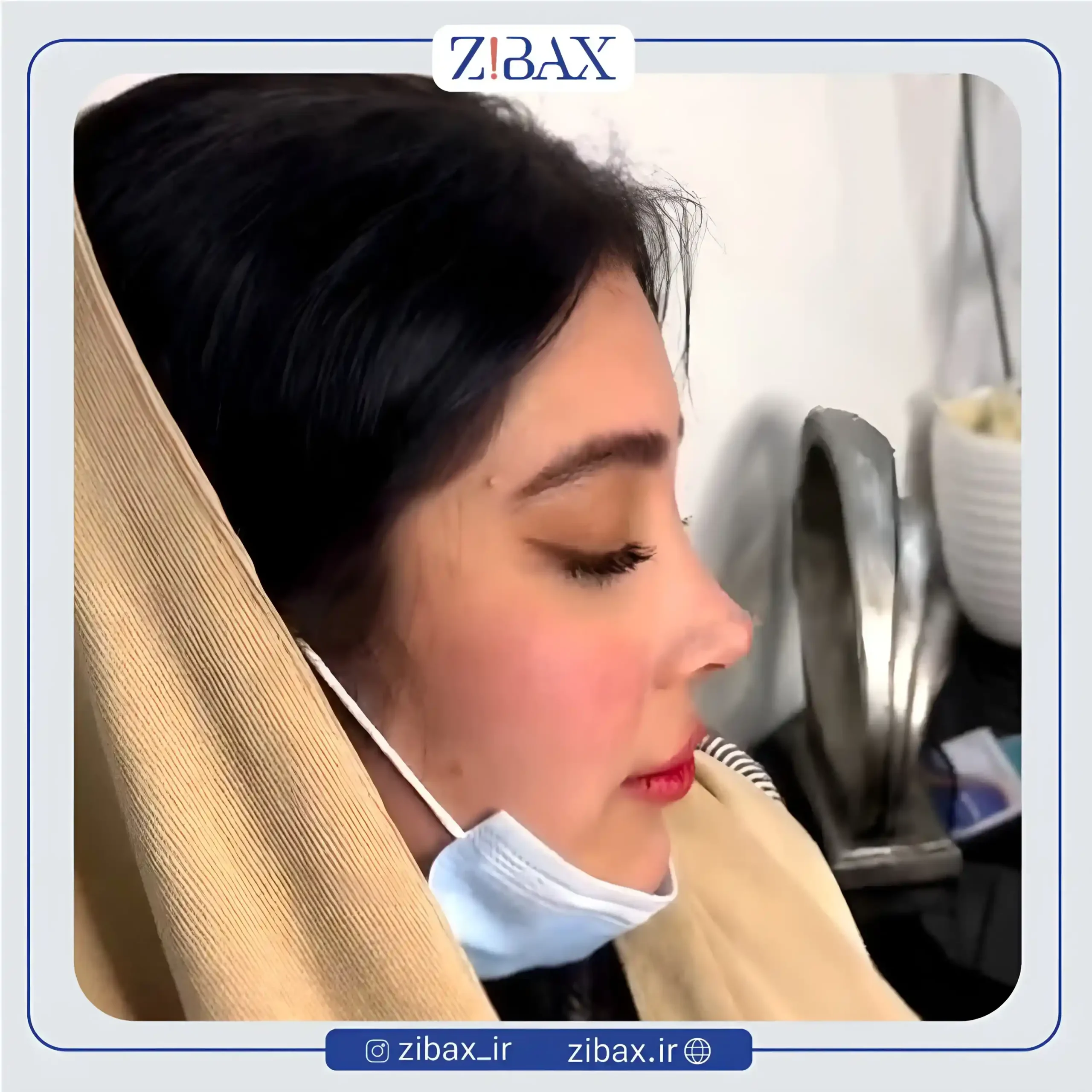 نمونه عمل جراحی بینی دکتر آرش شرفیان — تصویر 10