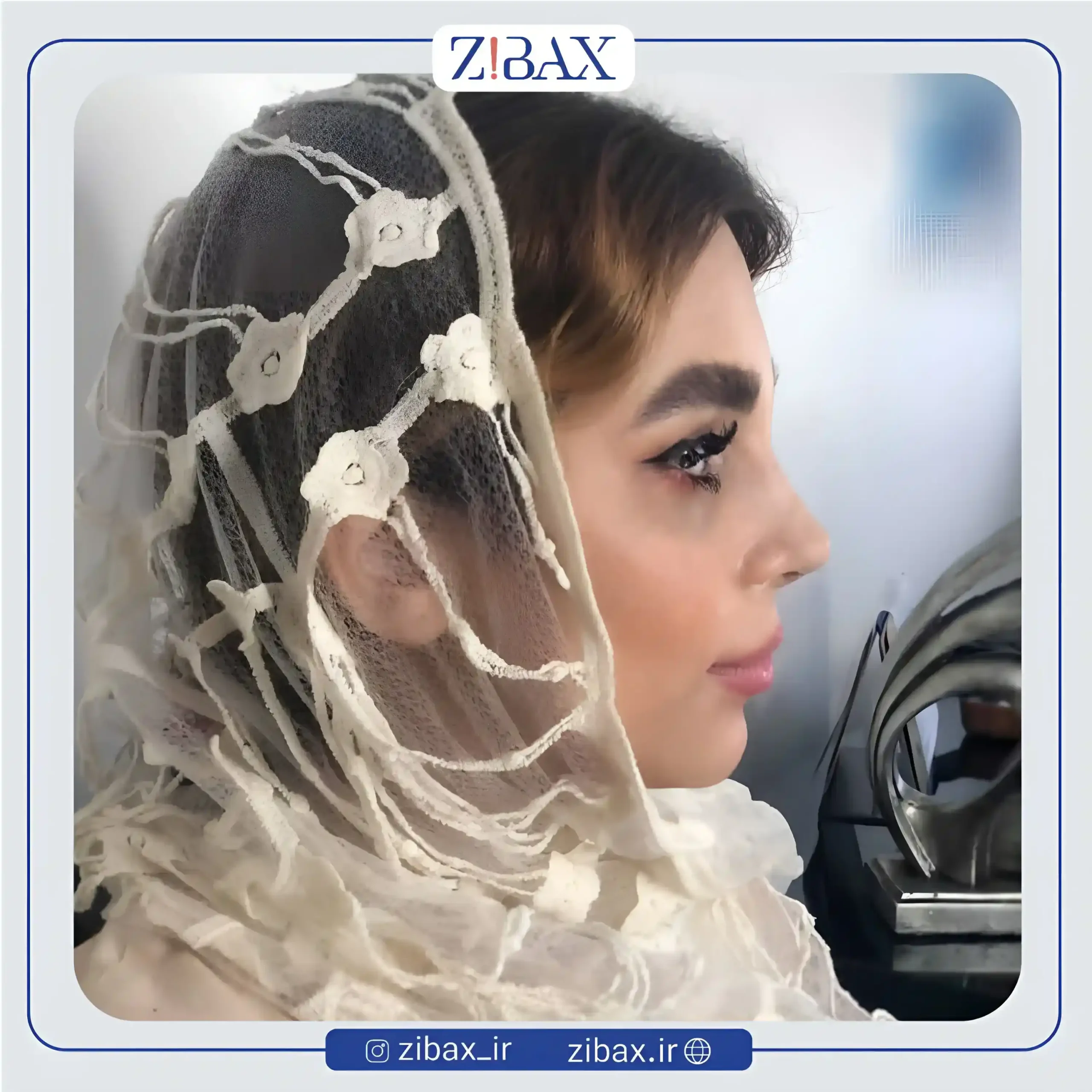 نمونه عمل جراحی بینی دکتر آرش شرفیان — تصویر 9