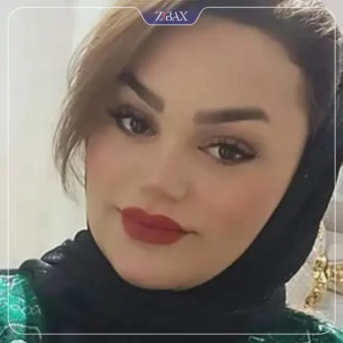 نمونه عمل جراحی بینی دکتر بابک خسرویان — تصویر 3