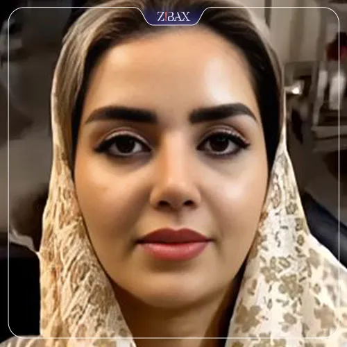 نمونه عمل جراحی بینی دکتر بابک خسرویان — تصویر 5