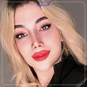 نمونه عمل جراحی بینی دکتر رضا وقر دوست — تصویر 1