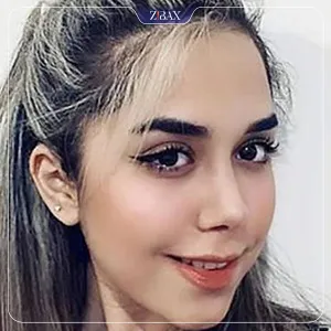 نمونه عمل جراحی بینی دکتر رضا وقر دوست — تصویر 4
