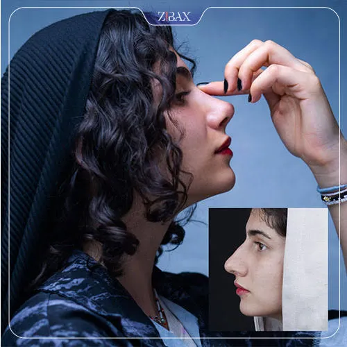 عکس عمل بینی نیمه فانتزی