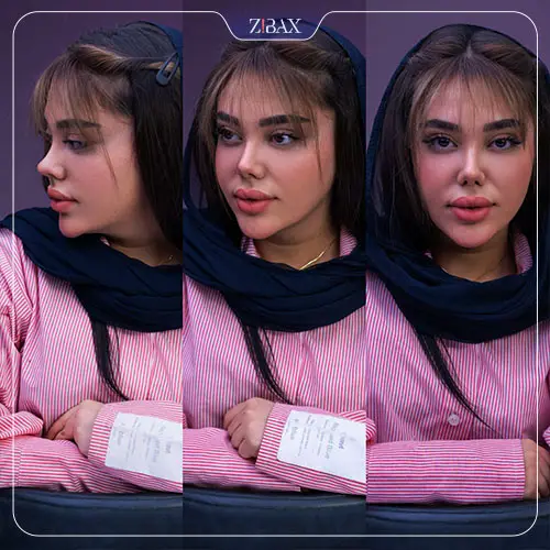 عکس بینی نیمه فانتزی نوک تیز